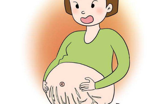 妊娠纹红色的是女孩吗 为什么是红色