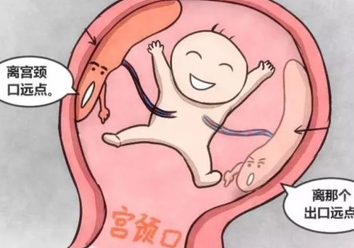 前置胎盘什么时候可以检查出来 症状有哪些