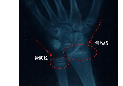 女子怀孕后能长高吗 能变矮吗