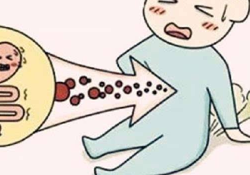 放屁是健康的吗 很响是什么原因