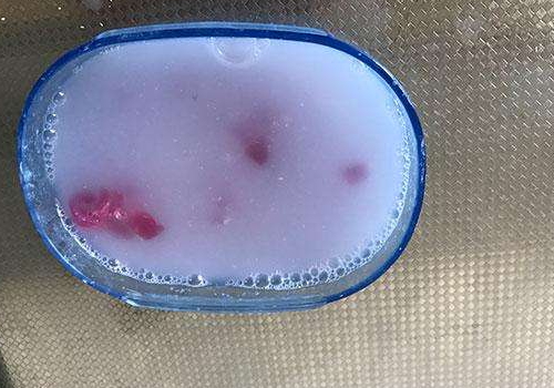 肥皂水能驱蚊吗 怎么做