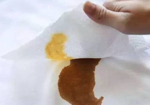 酱油渍怎么洗 溅到墙上怎么去除