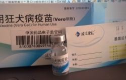 打狂犬疫苗注意事项